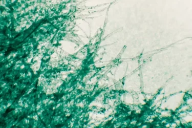 microscopic view of pulp fibres microscopic view of pulp fibres